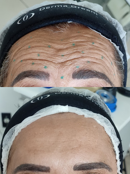 Foto 3 de Dra Cristiane Ribeiro - Ortodontia e Harmonização Ozonizada