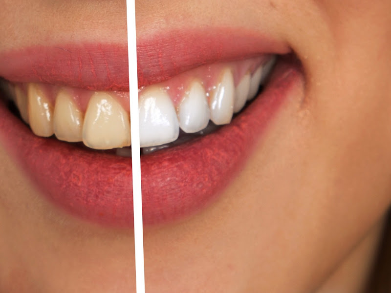 Foto 10 de Dra. Cristiane Romero | Dentista na República | São Paulo