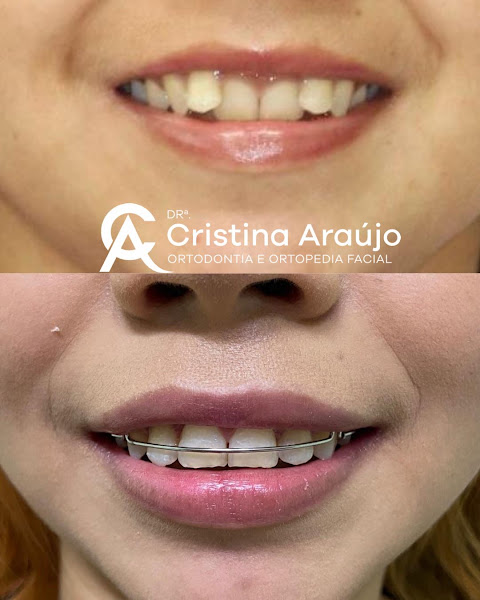 Foto 2 de Dra. Cristina Araújo-Dentista