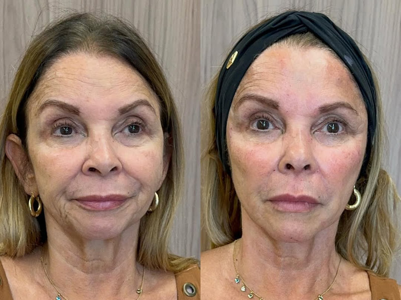 Foto de Dra Cristina Licio | Clínica de Harmonização Facial e Otomodelação em Belo Horizonte