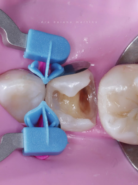 Foto 3 de Dra Daiana Martins - Dentista em Petrolina