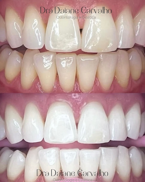 Foto 2 de Dra. Daiane Carvalho | Dentista Barra Funda