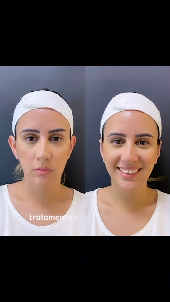 Foto 3 de Dra. Daira Saraiva - Odontologia e Estética - Juiz de Fora
