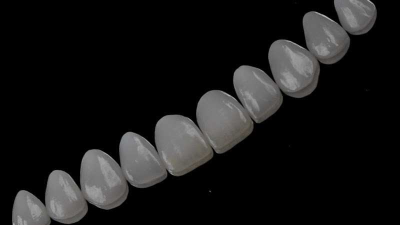 Foto 2 de Dra Dalila Messias - Odontologia Especializada e Harmonização Facial