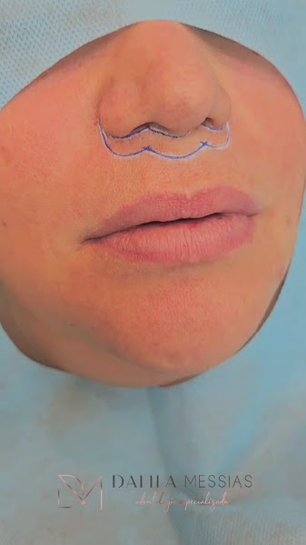 Foto 3 de Dra Dalila Messias - Odontologia Especializada e Harmonização Facial