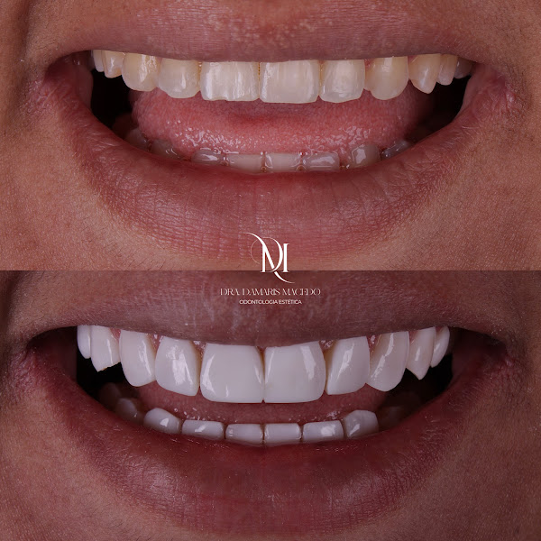 Foto 3 de Dra. Damaris Macedo | Especialista em Facetas