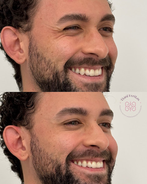 Foto 3 de Dra. Dani Freitas - Harmonização Orofacial