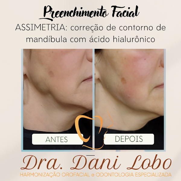 Foto 3 de Dra.Dani Lobo Odontologia Especializada e Harmonização Orofacial