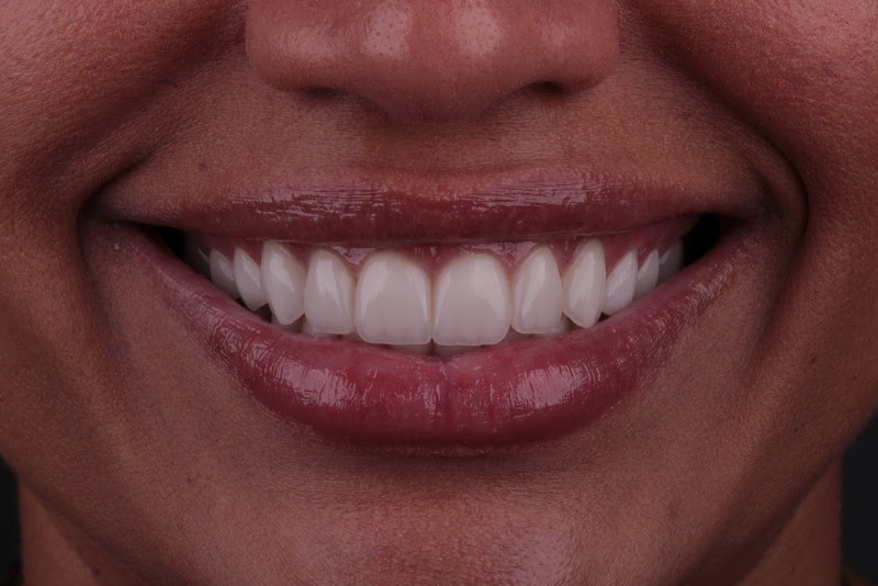 Foto 2 de Dra. Daniela Borges -Odontologia e Harmonização Orofacial
