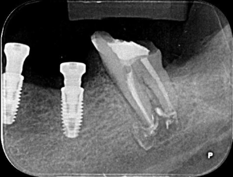 Foto 3 de Dra. Daniela Canasci | Endodontista | Tratamento de Canal BH e Contagem | Dentista BH e Contagem