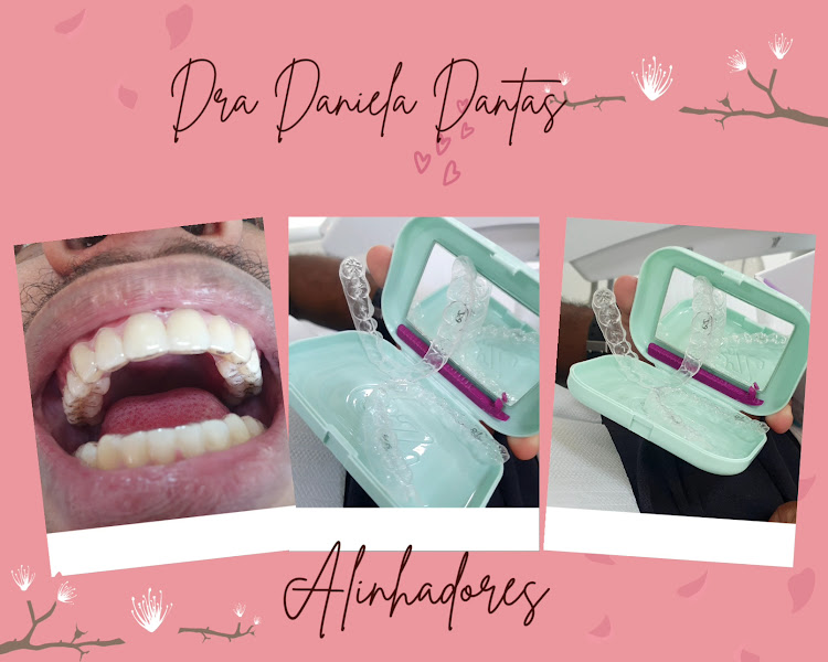 Foto 3 de Dra. Daniela Dantas DENTISTA Ortodontia e Protese Dentária