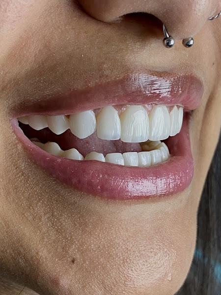 Foto 2 de Dra. Daniela Fersan | ODONTOLOGIA ESTÉTICA