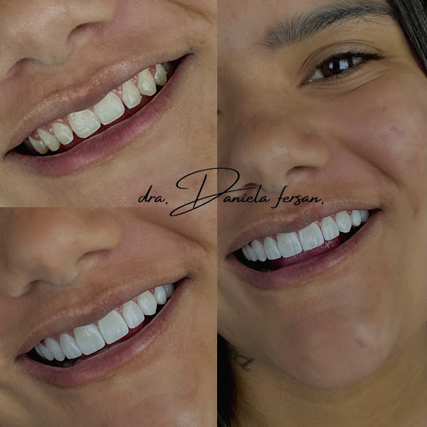 Foto 3 de Dra. Daniela Fersan | ODONTOLOGIA ESTÉTICA