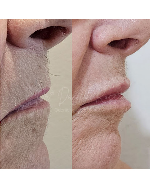 Foto de Dra Daniela Rossi - Harmonização Orofacial - Botox - Preenchimento Labial - Bioestimuladores