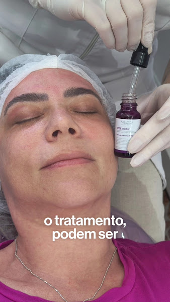 Foto 3 de Dra Daniela Schioser | Cirurgiã-dentista & Harmonização Orofacial em Jundiaí-SP