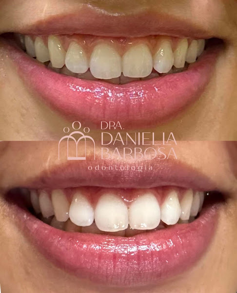 Foto 3 de Dra. Daniella Barbosa - Dentista | Clareamento Dental - Clínica Barbosa e Sousa Odontologia