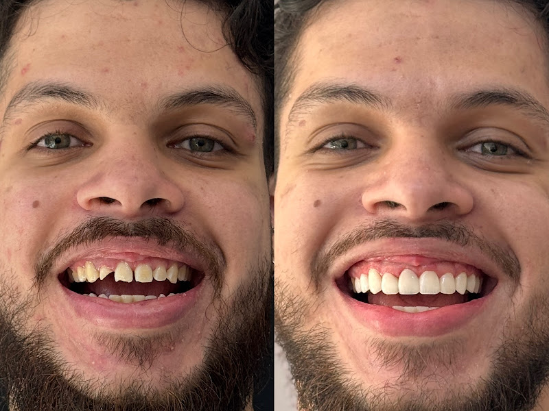 Foto 6 de Dra. Danielle Albuquerque | Cirurgiã-Dentista