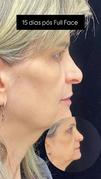 Foto 3 de Dra Danielle Carvalho Odontologia Estética