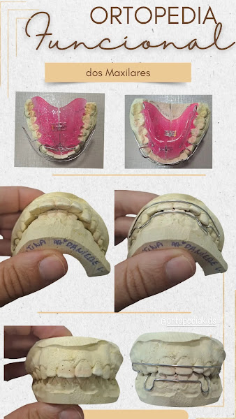 Foto 4 de Dra Danielle Lacerda - Odontopediatria e Ortodontia Infantil (Itacorubi)