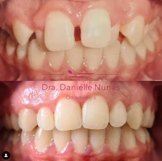 Foto 2 de DRA. DANIELLE NUNES ODONTOLOGIA