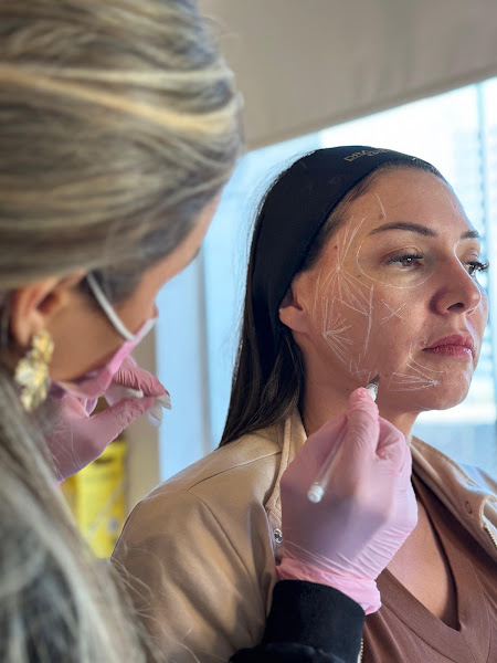 Foto 3 de Dra. Darliane Sá Harmonização em Jundiaí/SP | Botox | Preenchimento Labial | Sculptra | Microagulhamento