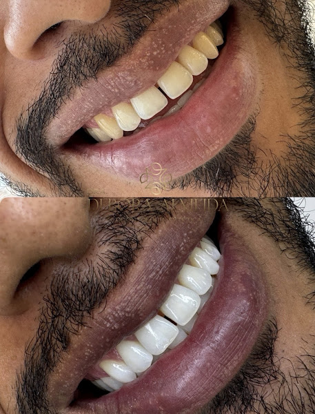 Foto 2 de Dra Débora Almeida | Dentista