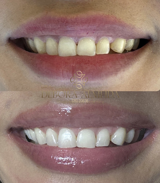 Foto 3 de Dra Débora Almeida | Dentista