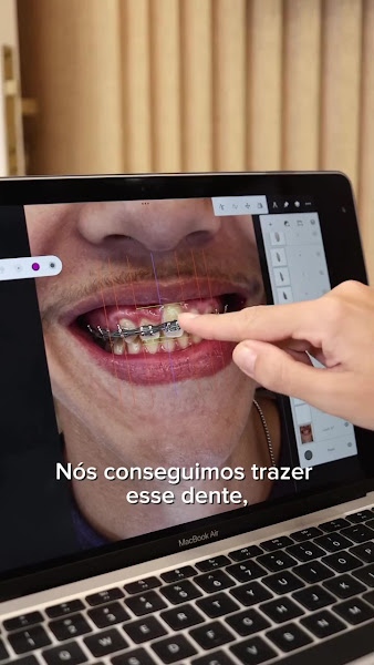 Foto 3 de Dra. Débora Camilo | Clínica Odontológica - Cachambi/RJ