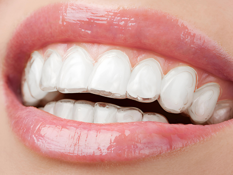 Foto 8 de Dra. Deborah Bignardi | Dentista em Moema