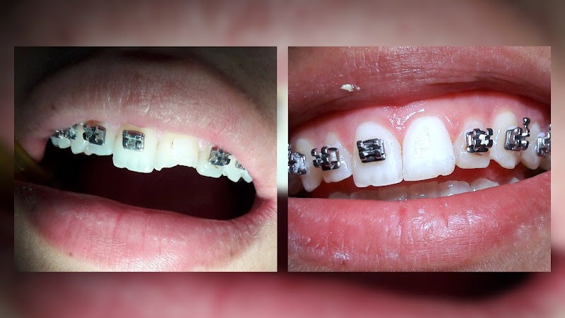 Foto 2 de Dra Denise Angelini Silva