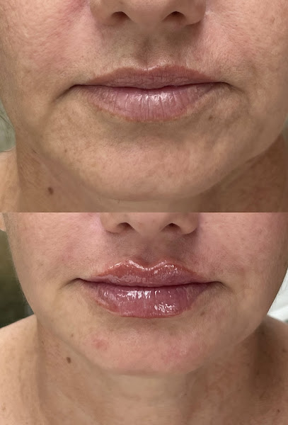 Foto 2 de Dra Denise Duarte | Odontologia e Harmonização Facial