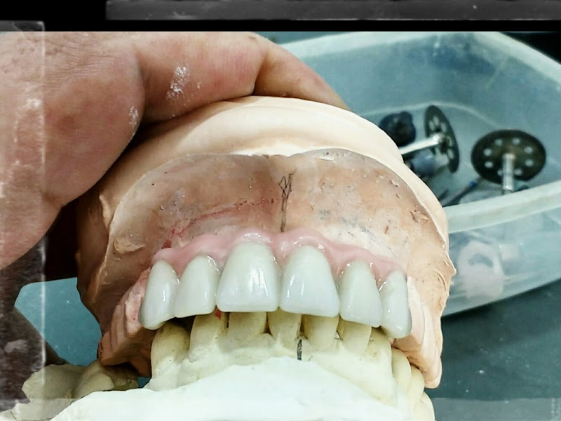 Foto 3 de Dra. Denise Menezes Odontologia | Dentista em Santa Cruz | Clareamento Dental | Prótese Dentaria | Aparelho Ortodôntico