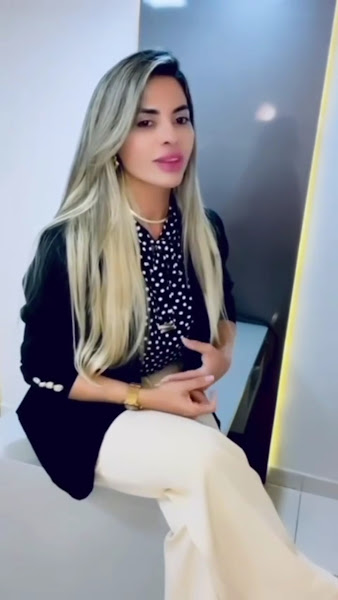 Foto 3 de Dra.Diana Braga | Preenchimento Labial | Harmonização facial em Manaus