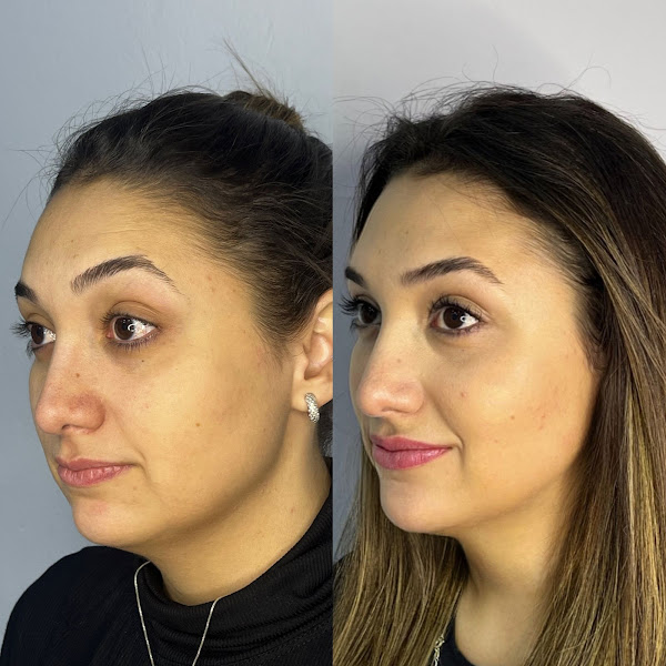 Foto 3 de Dra. Dilane Costa | Especialista em Full Face | Harmonização Facial