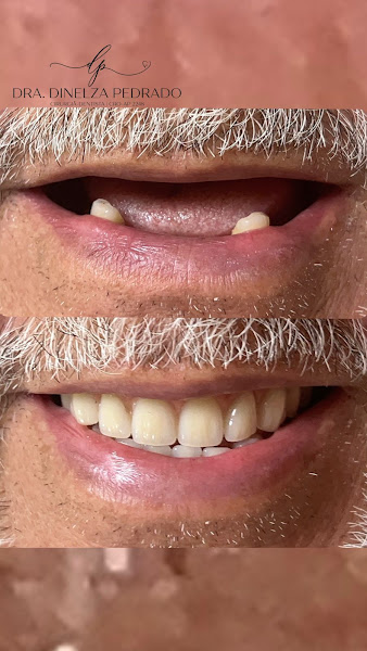 Foto 2 de Dra. Dinelza Pedrado | Prótese Dentária e Atendimento Humanizado