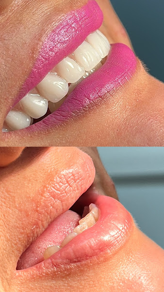 Foto 3 de Dra. Dinelza Pedrado | Prótese Dentária e Atendimento Humanizado