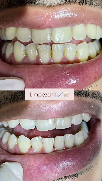 Foto 3 de Dra. Dinne - Dentista em Ananindeua