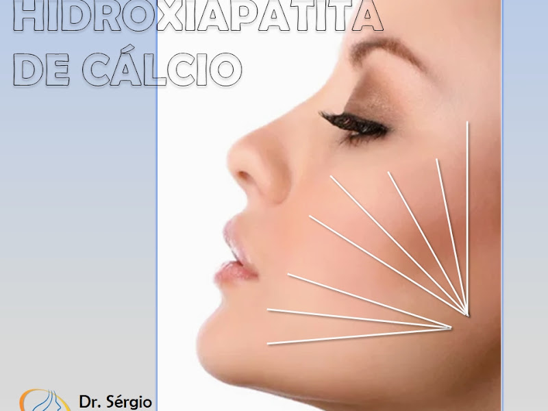 Foto 3 de Dra. Donizett Fedozzi Cirurgiã Dentista