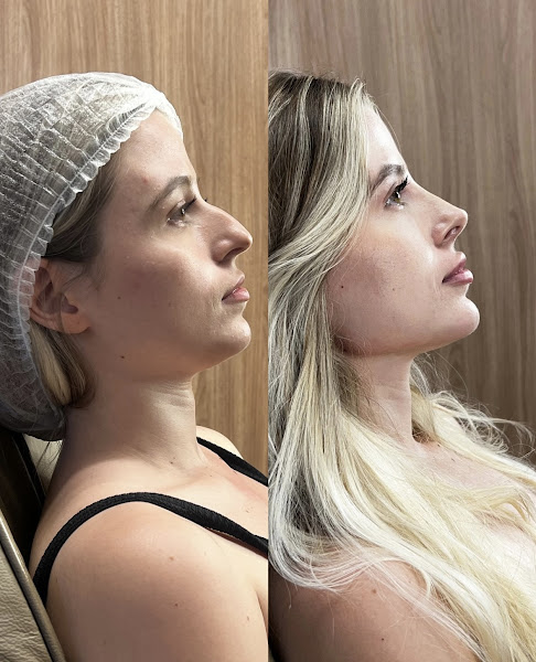 Foto 3 de Dra Driellen Zarpellon - Linea Clínica da Face