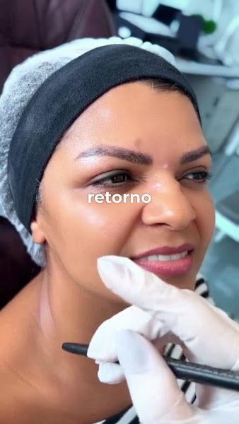 Foto 2 de Dra. Dulce Cruz | Harmonização Orofacial