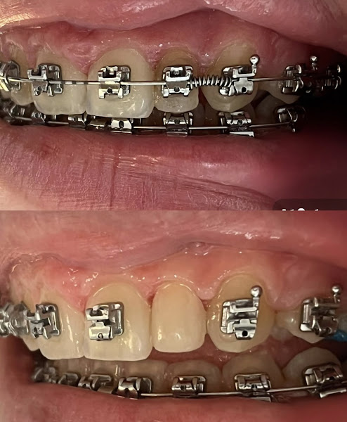 Foto 2 de Dra. Edineide Melo | Dentista em Blumenau