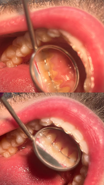 Foto 3 de Dra. Eduarda Fortkamp | Dentista