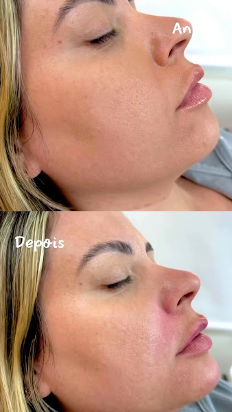 Foto 4 de Dra.Eduarda Monteiro | Dentista em Recife