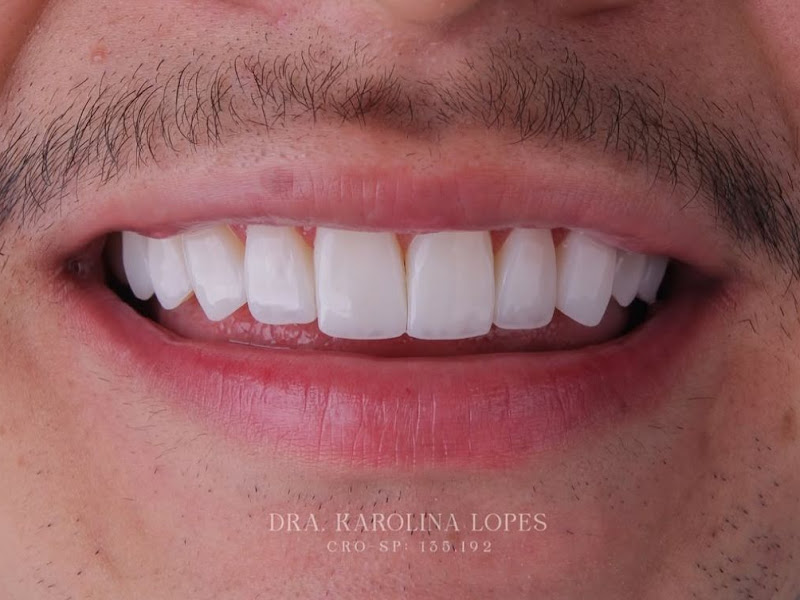 Foto 7 de Dra. Elaine Campos - Odontologia estética e Orofacial | Higienópolis