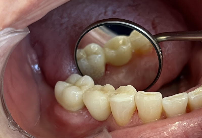 Foto 2 de Dra. Elaine O. Machado- Odontologia Reabilitadora