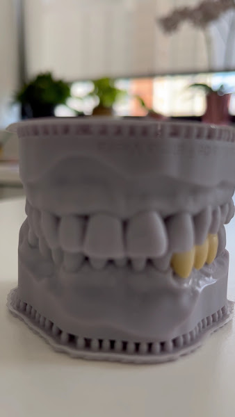 Foto 3 de Dra. Elaine O. Machado- Odontologia Reabilitadora