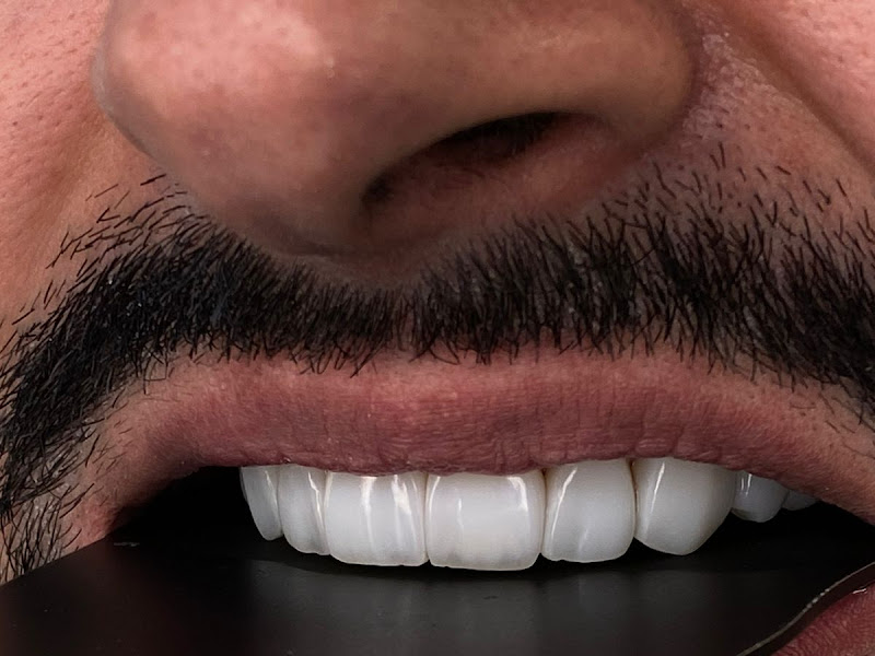 Foto 8 de Dra. Elaine O. Machado- Odontologia Reabilitadora