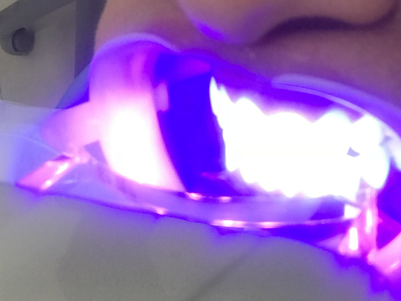 Foto 3 de Dra Elcia Bravin - Microscopia Endodôntica e Harmonização Orofacial