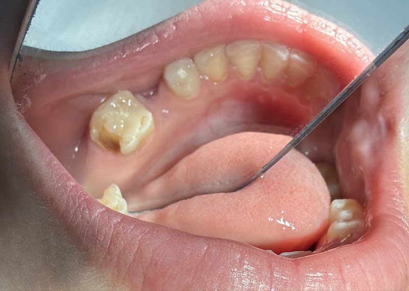 Foto 3 de Dra. Elen Castiel Odontologia