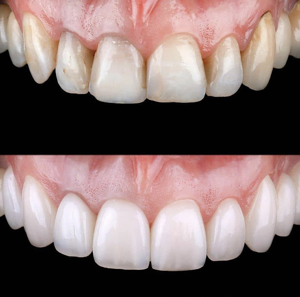 Foto 3 de Dra Elen Vicco / Felicità Odontologia Integrada